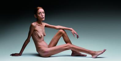 Oliviero Toscani, No Anorexia, 2007, ©olivierotoscani